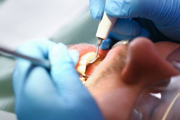 Urgent Tooth Repair in OR